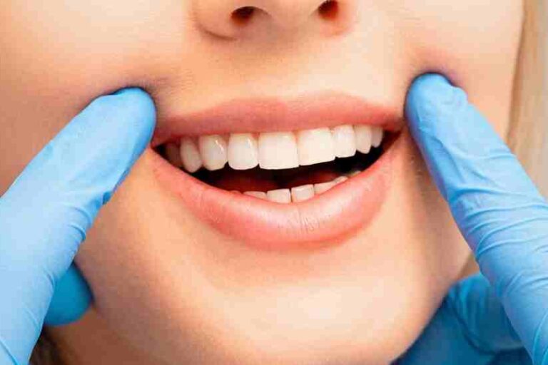 dr onur ademhan-teeth whitening Why Teeth Whitening in Antalya is So Popular? dr onur ademhan at perla dental clinics