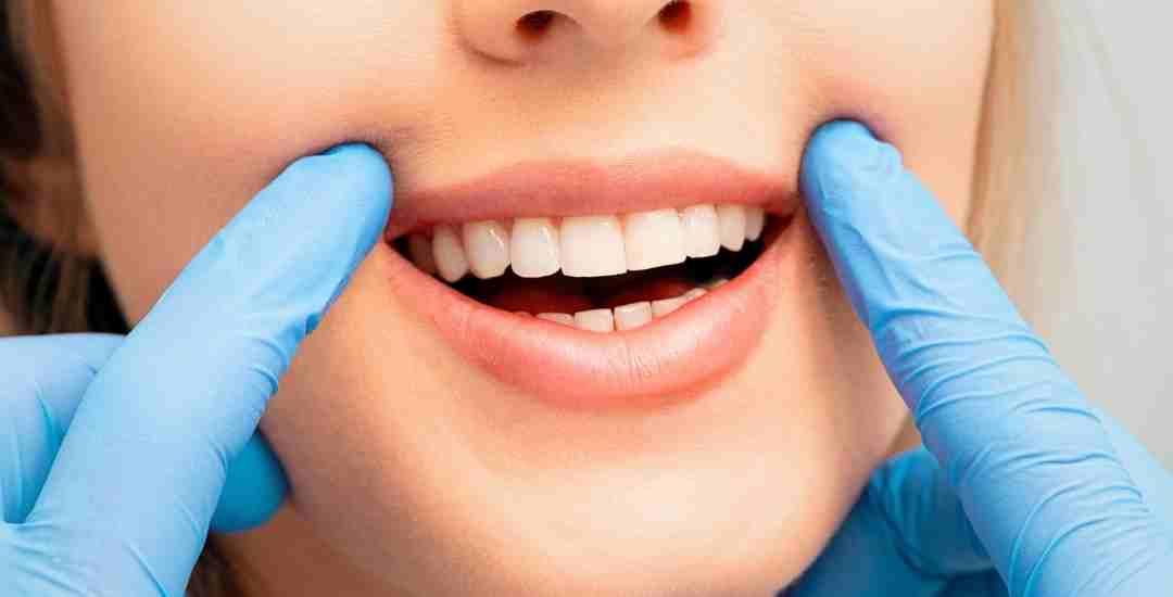 Why Teeth Whitening in Antalya is So Popular? dr onur ademhan at perla dental clinics