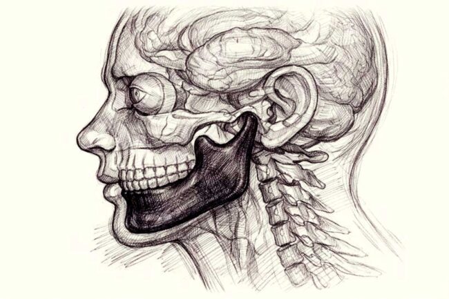 Corrective jaw surgery, also called orthognathic surgery, changes the structure of your upper or lower jaw to bring it into proper alignment.