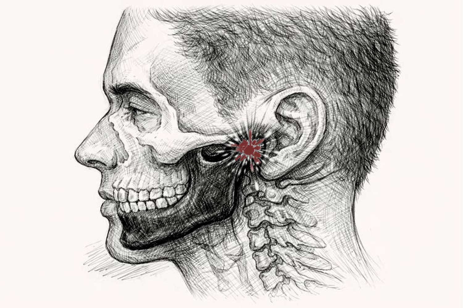 TMJ disorder treatment in Antalya by oral and maxillofacial surgeon Dr. Onur Ademhan