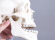 TMJ nedir sorusunu açıklayan çene eklemi bölgesini gösteren anatomik kafatası modeli, dr onur ademhan oral and maxillofacial surgeon
