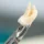 For the wisdom tooth extraction blog hero image, use this: Alt Text: Wisdom tooth extraction showing impacted third molar and oral surgery planning More natural version: Impacted wisdom tooth evaluation before wisdom tooth extraction SEO-focused version: Wisdom tooth extraction for impacted wisdom tooth with oral surgery evaluation My recommendation: Impacted wisdom tooth evaluation before wisdom tooth extraction. Dr. Onur Ademhan