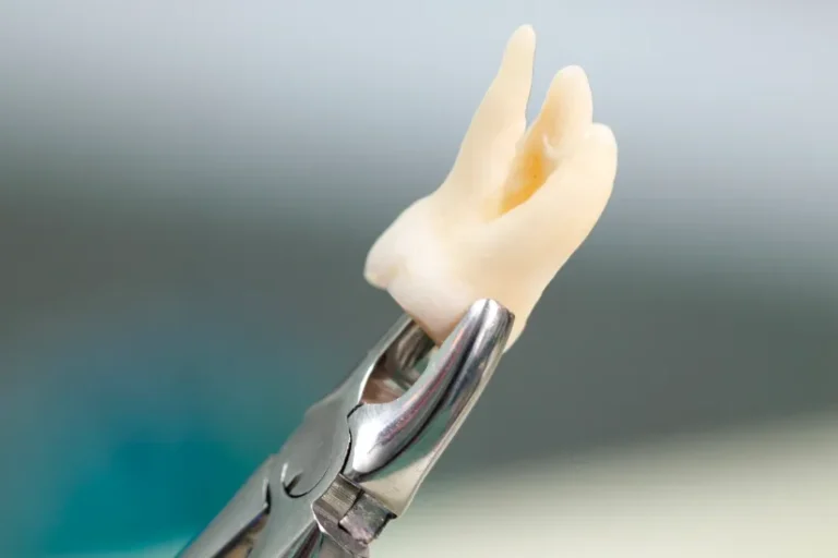For the wisdom tooth extraction blog hero image, use this: Alt Text: Wisdom tooth extraction showing impacted third molar and oral surgery planning More natural version: Impacted wisdom tooth evaluation before wisdom tooth extraction SEO-focused version: Wisdom tooth extraction for impacted wisdom tooth with oral surgery evaluation My recommendation: Impacted wisdom tooth evaluation before wisdom tooth extraction. Dr. Onur Ademhan