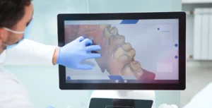 Çene kisti teşhisinde kullanılan dental tomografi ve röntgen görüntüleme. dr onur ademhan