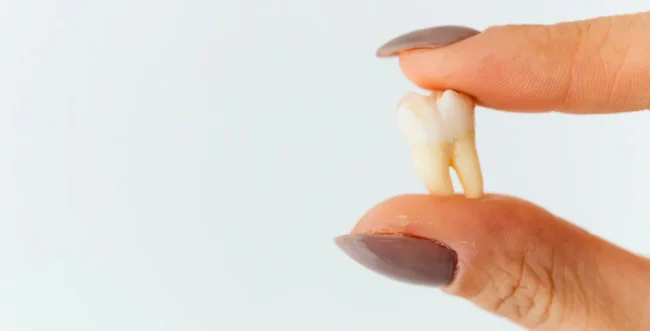 How Long Does Tooth Extraction Take to Heal? Tooth extraction healing and aftercare explained by dr onur ademhan