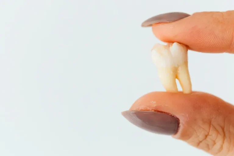 tooth extraction-after care How Long Does Tooth Extraction Take to Heal? Tooth extraction healing and aftercare explained by dr onur ademhan