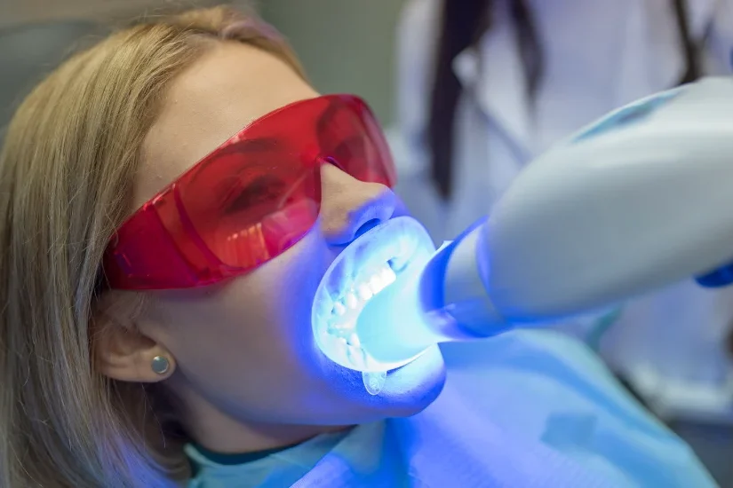 falsh-teeth-whitening flash diş beyazlatma klinikte
