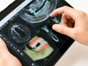 3D dental imaging and jaw scan used for jaw alignment evaluation and treatment planning, Dr. Onur Ademhan