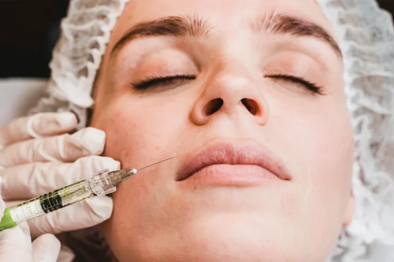 masseter botox-teeth grending Masseter Botox evaluation for teeth grinding in Antalya, Dr. Onur Ademhan